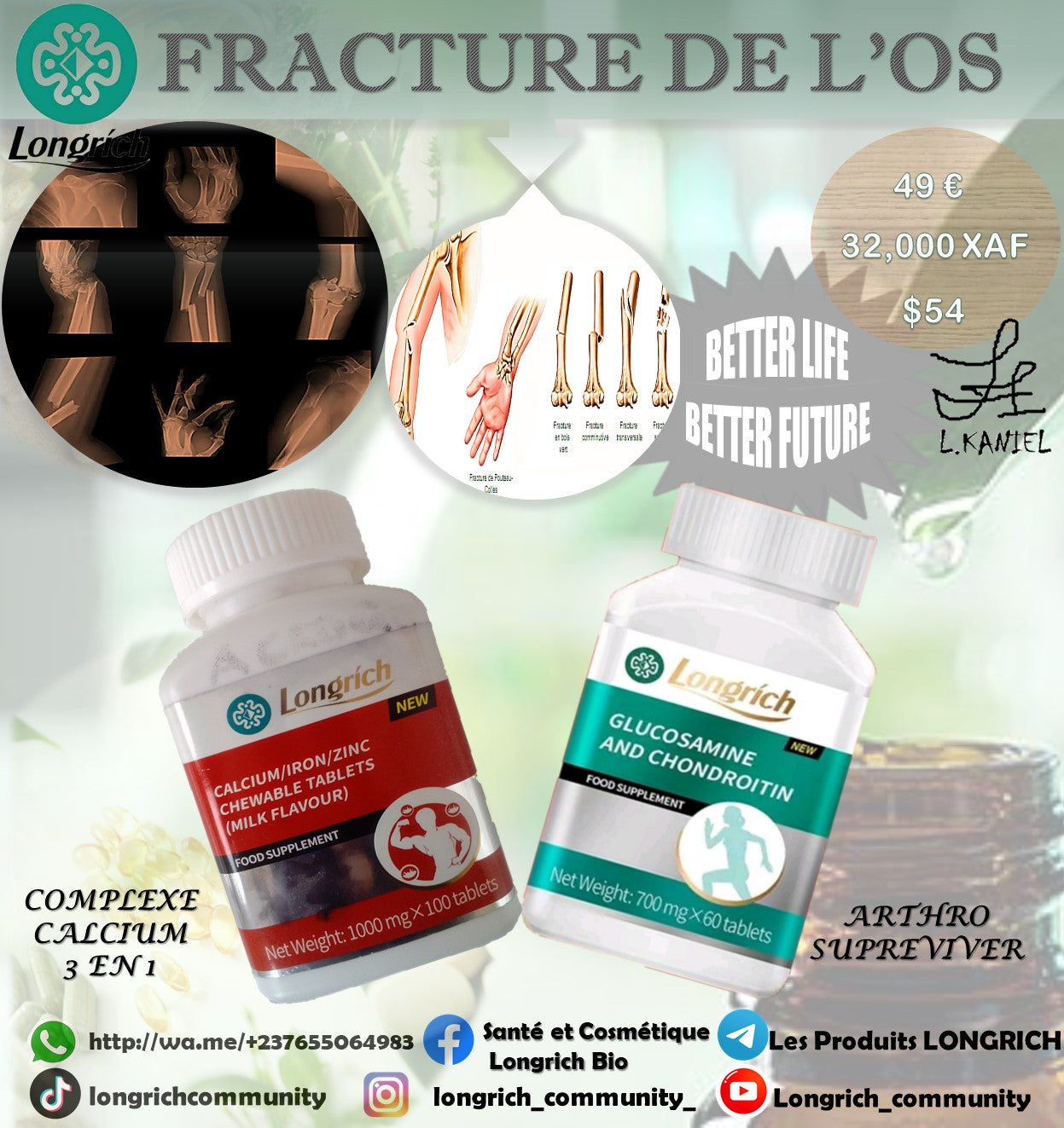 Fracture de l’Os Traitement Longrích